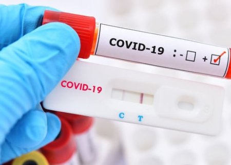 Son sutkada 1 nəfər COVID-19-a yoluxub