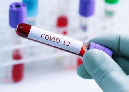 Azərbaycanda COVID-19-a yoluxanların sayı AÇIQLANDI