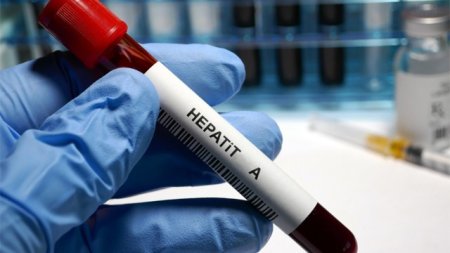 Nazirlikdən hepatit A infeksiyasına yoluxma halları ilə bağlı MƏLUMAT